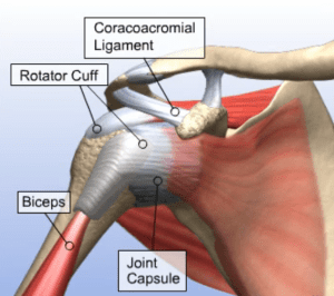 image of torn rotator cuff surgery