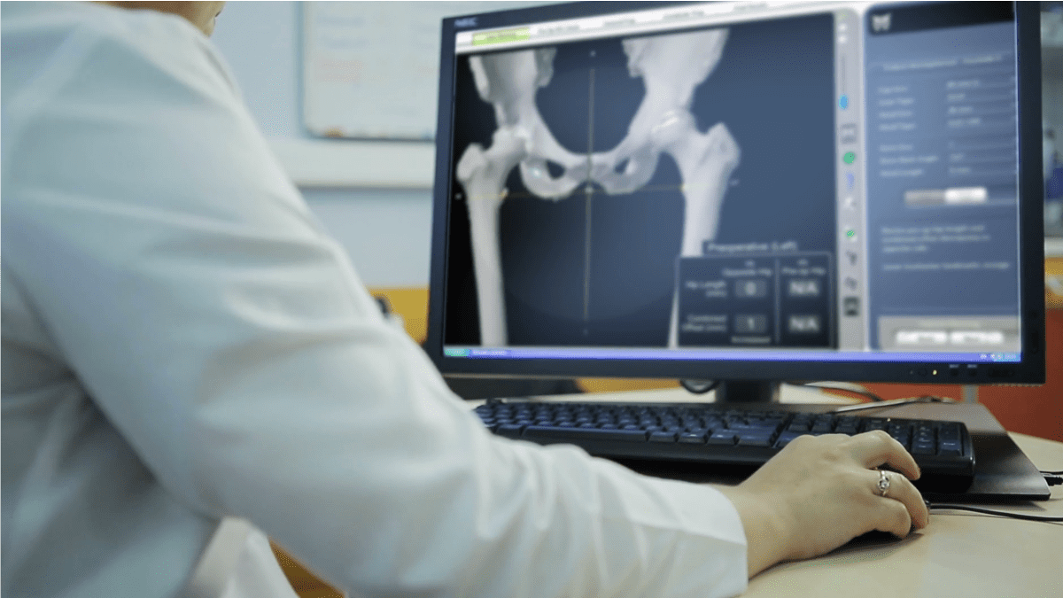 Robotic Total Hip Replacement - IOrtho